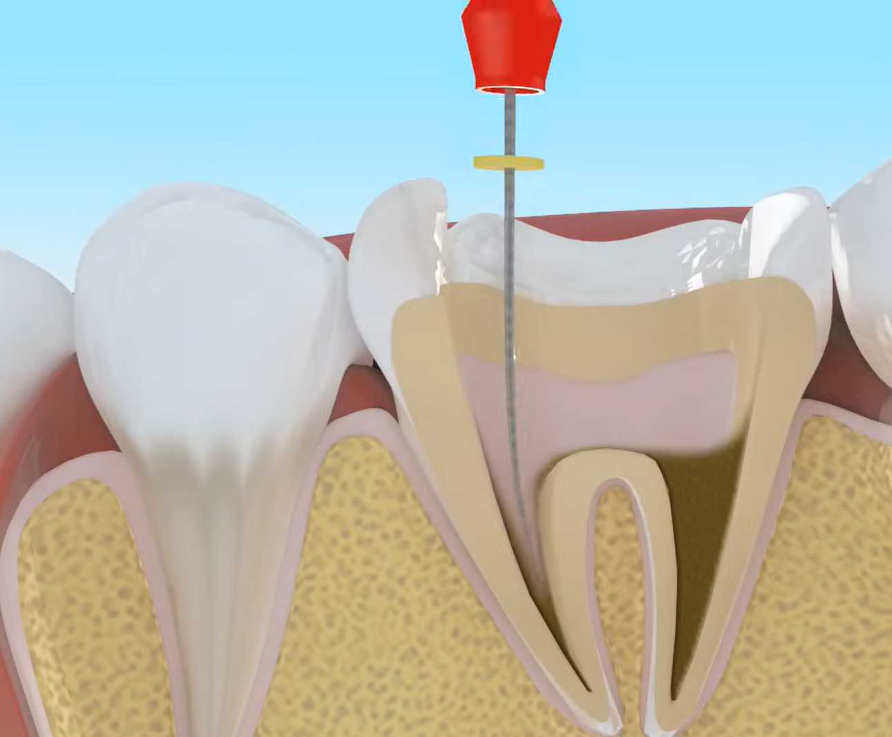 imagen Dentallink